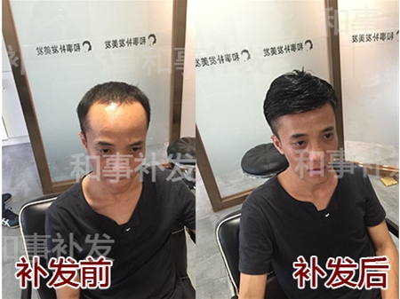 和事補(bǔ)發(fā)