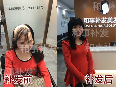 和事補(bǔ)發(fā)